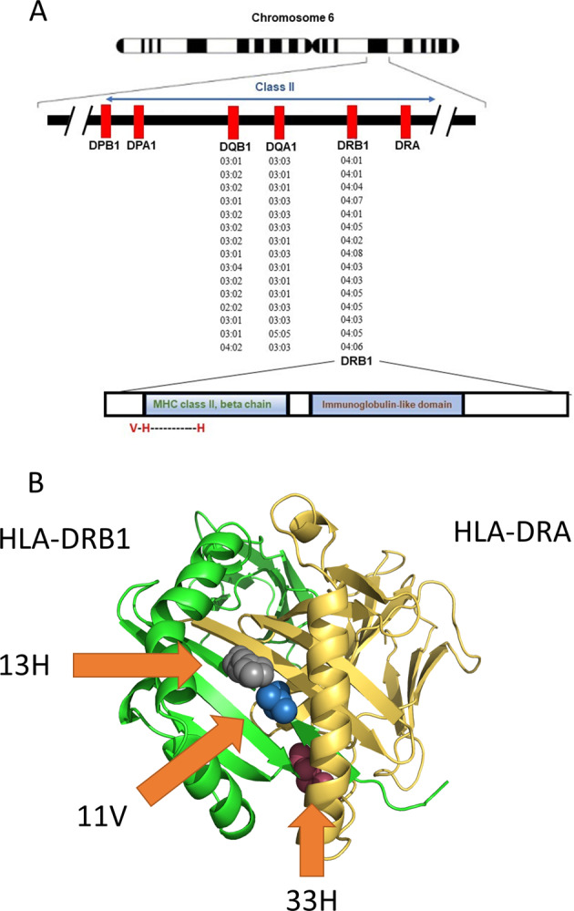 Fine mapping of the HLA locus in Parkinson’s disease in Europeans - PMC