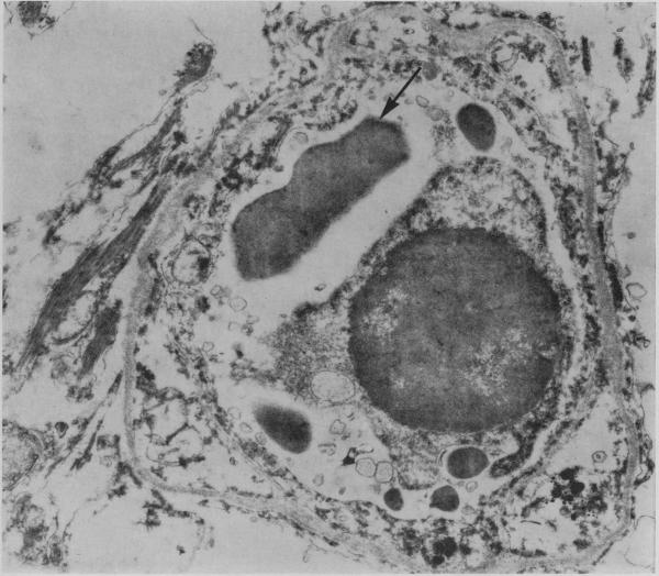 Fig. 28