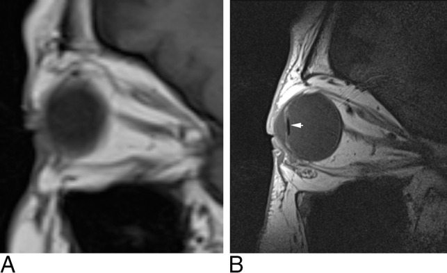 Fig 1.