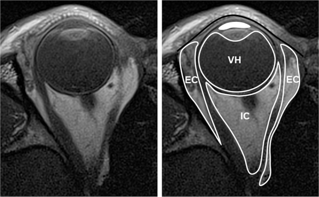 Fig 6.