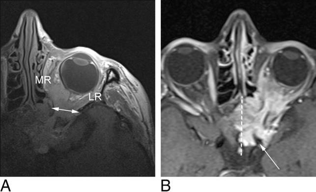 Fig 2.