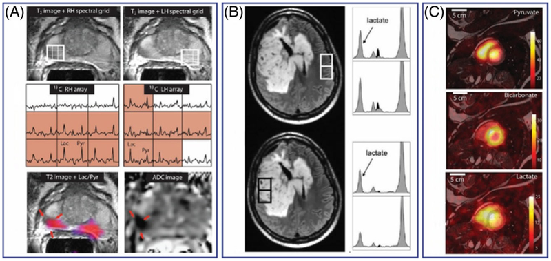 FIGURE 16