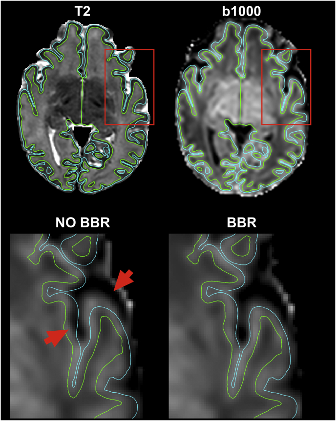 Fig. 6