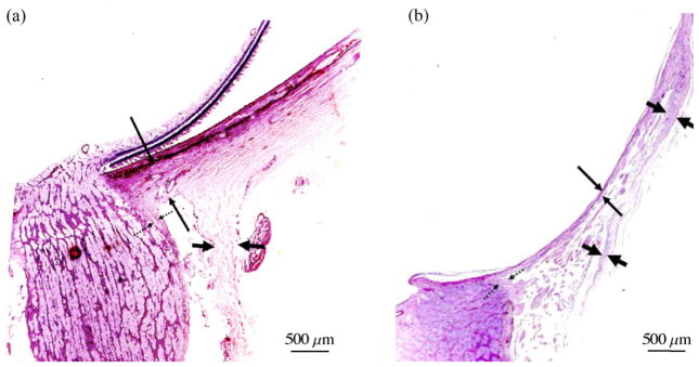 Fig. 11