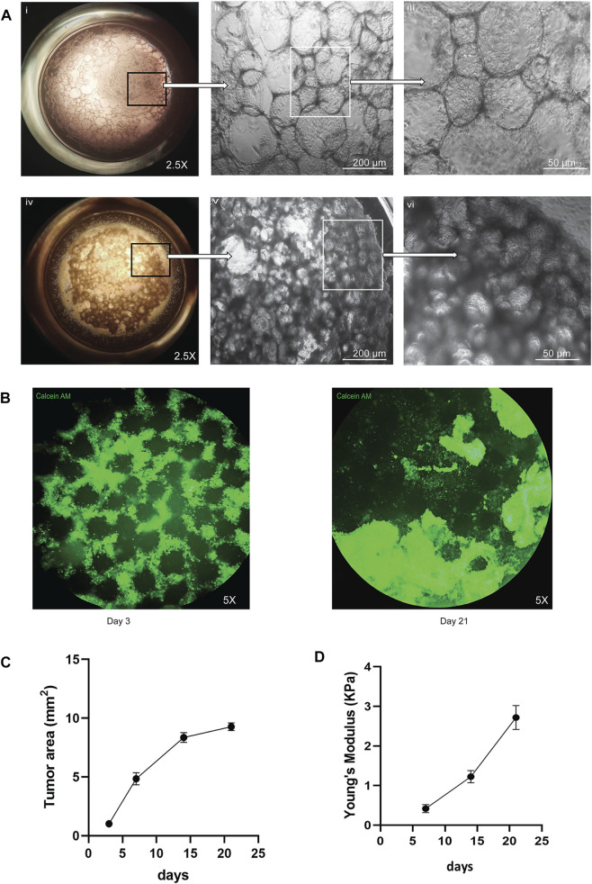 Development of a small cell lung cancer organoid model to study ...