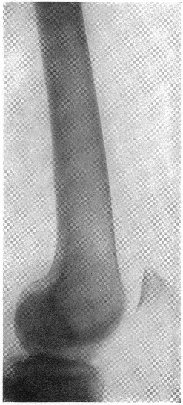 FIG. 5b.