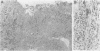 256