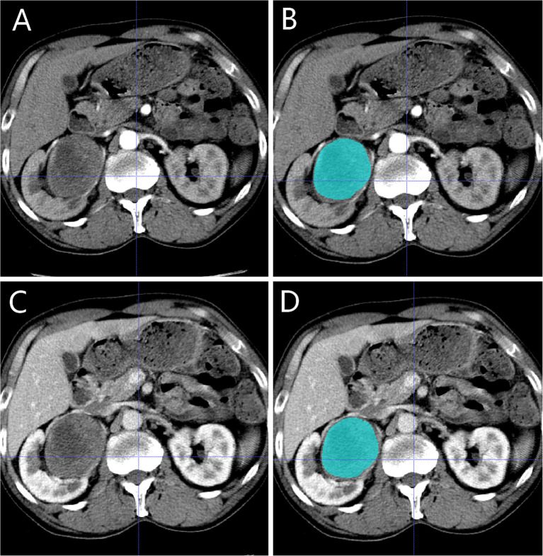 Figure 3