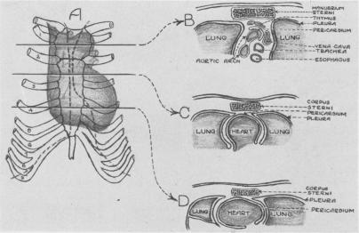 Fig. 13.