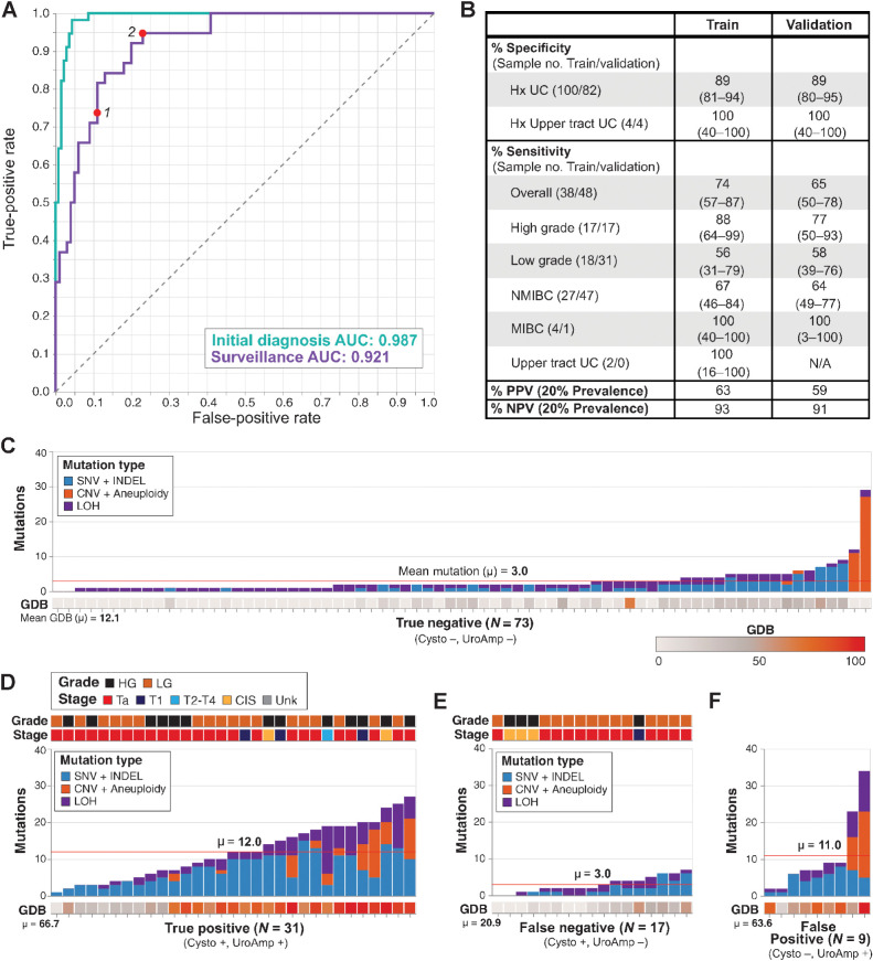 Figure 2. Binary classification of urothelial carcinoma surveillance patients. A, ROC curves for the training of initial diagnosis (n = 195) and surveillance (n = 138) cohorts. Points 1 and 2 denote performance for the specificity-prioritized and sensitivity-prioritized models, respectively. B, Disease classification performance for the surveillance cohort. Clinical demographic subsets include non-muscle invasive bladder cancer (NMIBC) and muscle invasive bladder cancer (MIBC). Values in parenthesis denote 95% confidence intervals. C–F, Mutation number, type, and genomic disease burden (GDB) for patients in the surveillance validation cohort. Stage and grade are indicated for the original primary tumor for (C) True Negative and (F) False Positive or the recurrent tumors in (D) True Positive and (E) False Negative. Mean mutation count and mean GDB are indicated for each group.