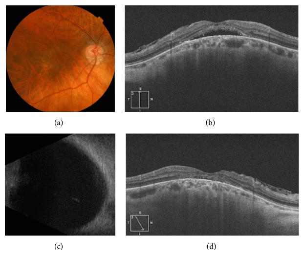 Figure 2