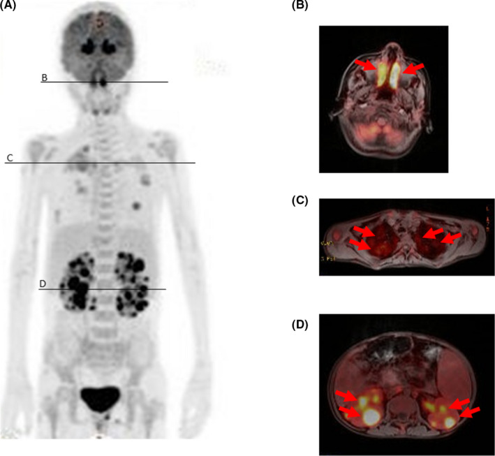 FIGURE 1