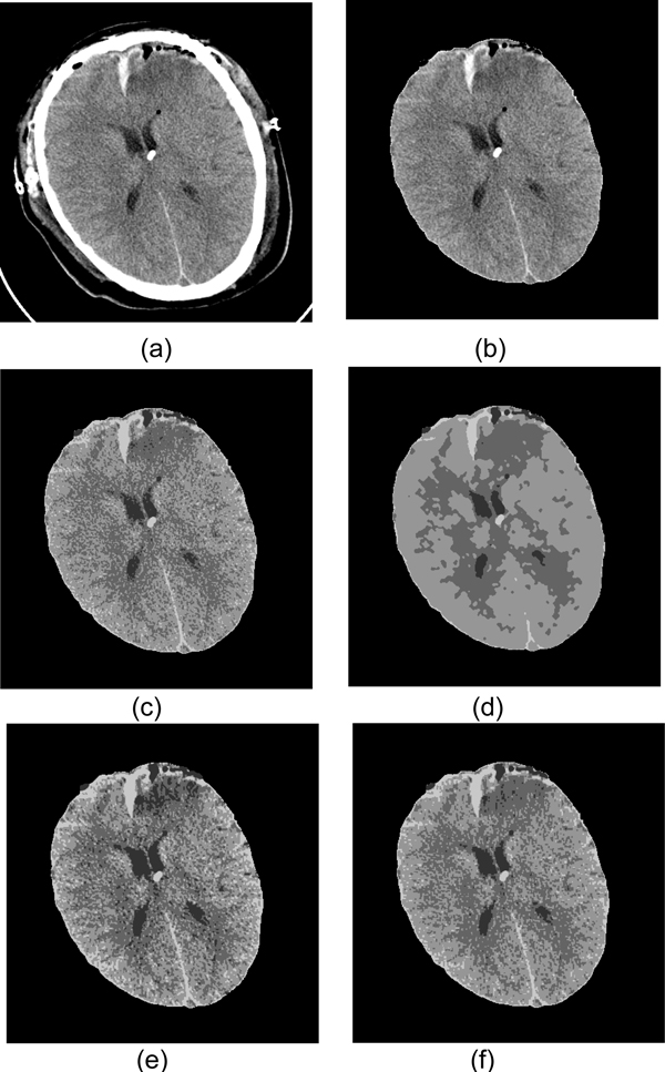 Figure 18