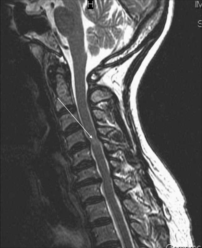 Figure 13.