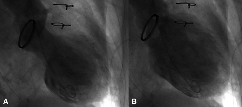 Figure E2