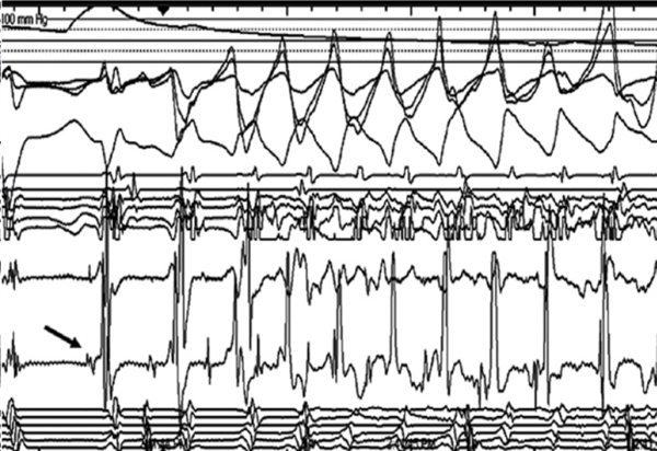 Figure 9