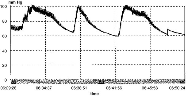 Fig. 22.9