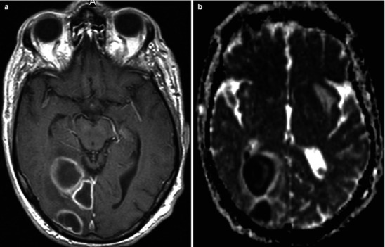 Fig. 22.16