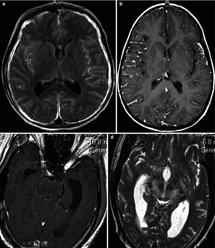 Fig. 22.5