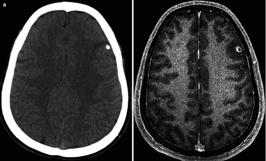 Fig. 22.29