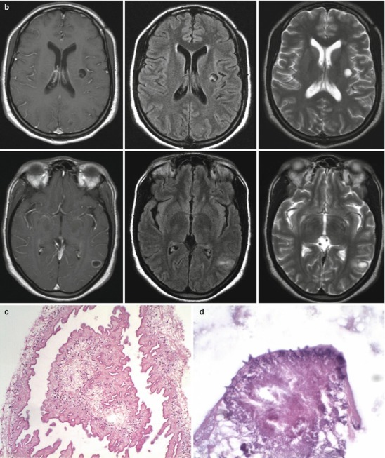 Fig. 22.29