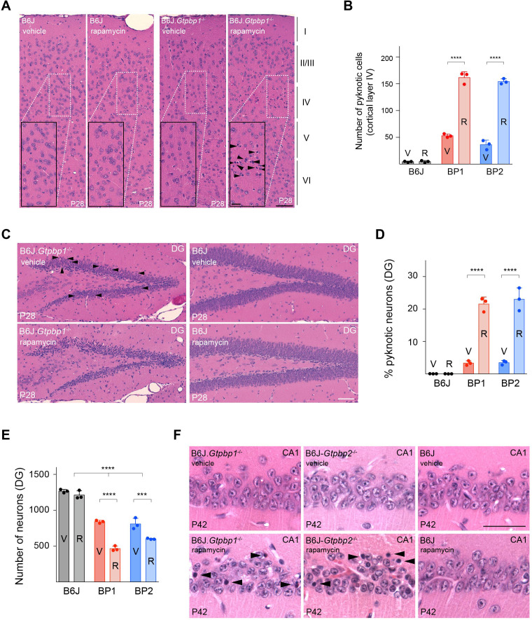 Figure 4—figure supplement 2.