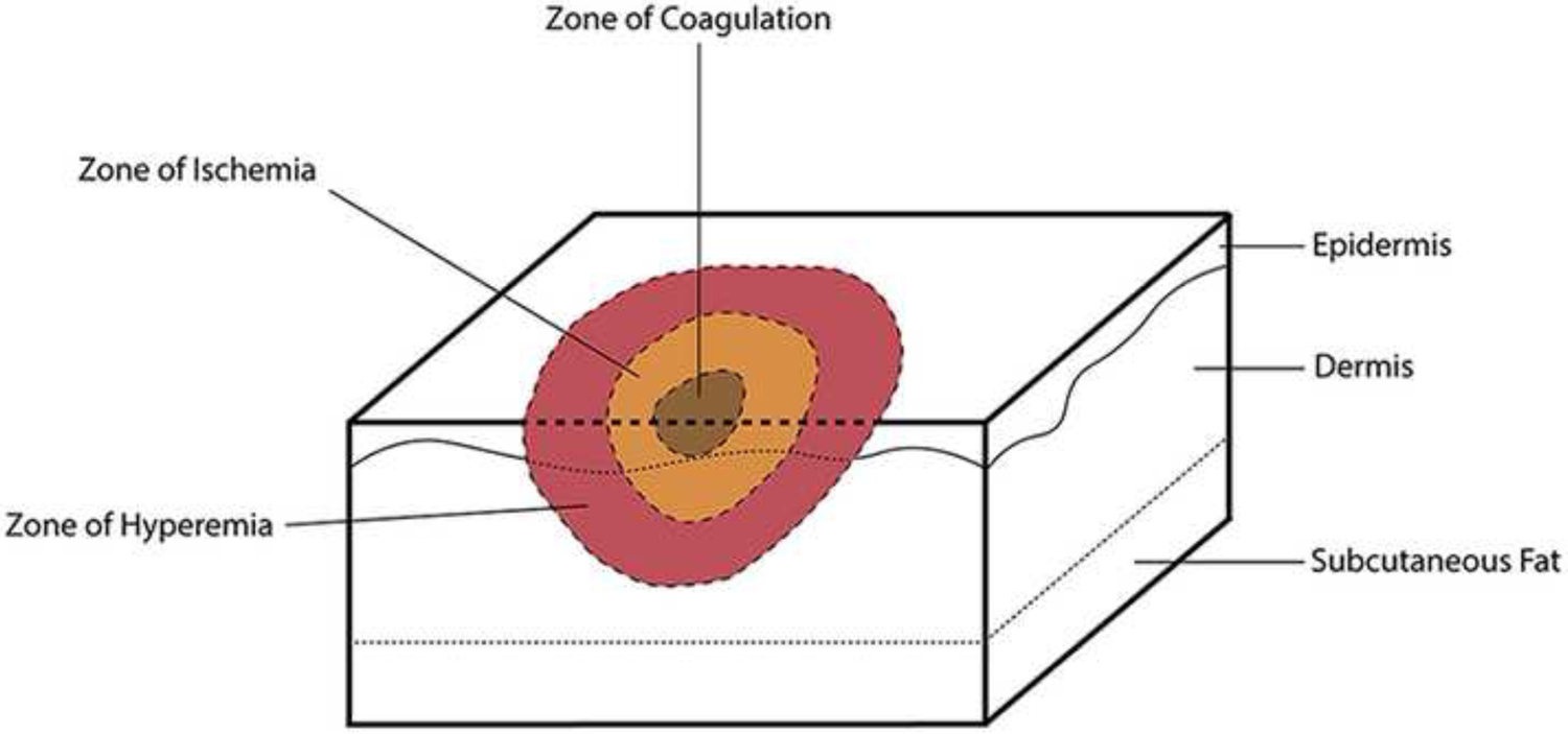 Figure 2: