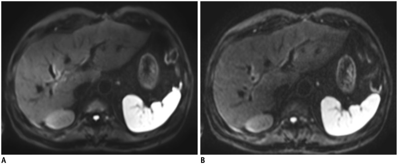 Fig. 17