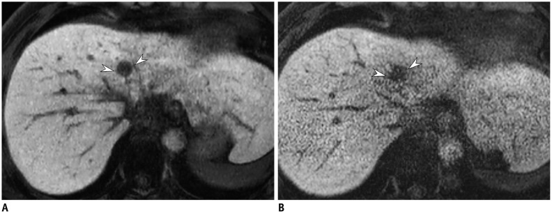 Fig. 13