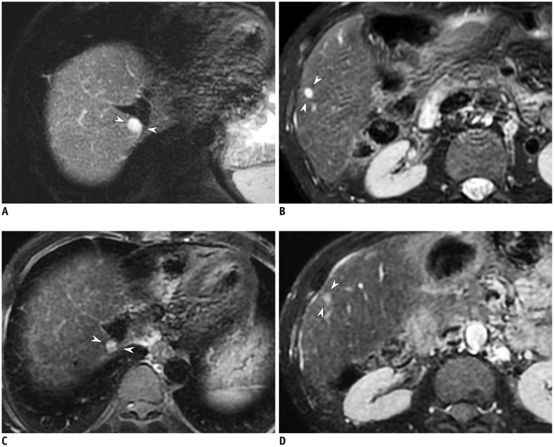 Fig. 14