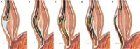 Fig 2.