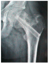 Fig. 4