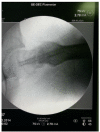 Fig. 10