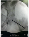 Fig. 6