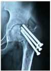 Fig. 1