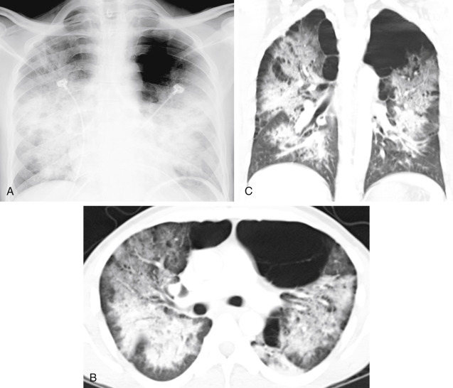 Fig. 15.8