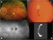 Fig. 1