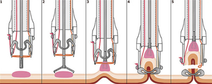 Figure 9