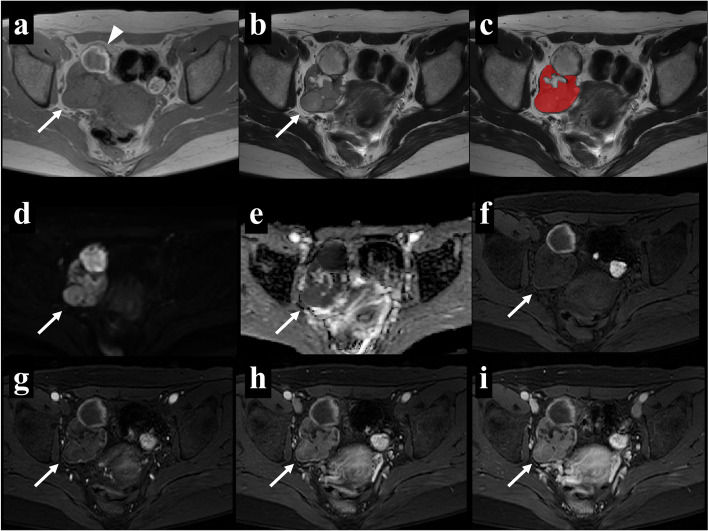 Fig. 3