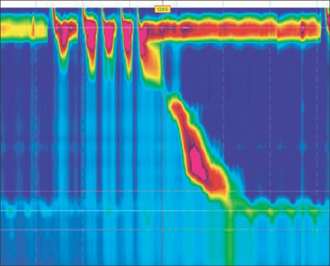 Figure 12