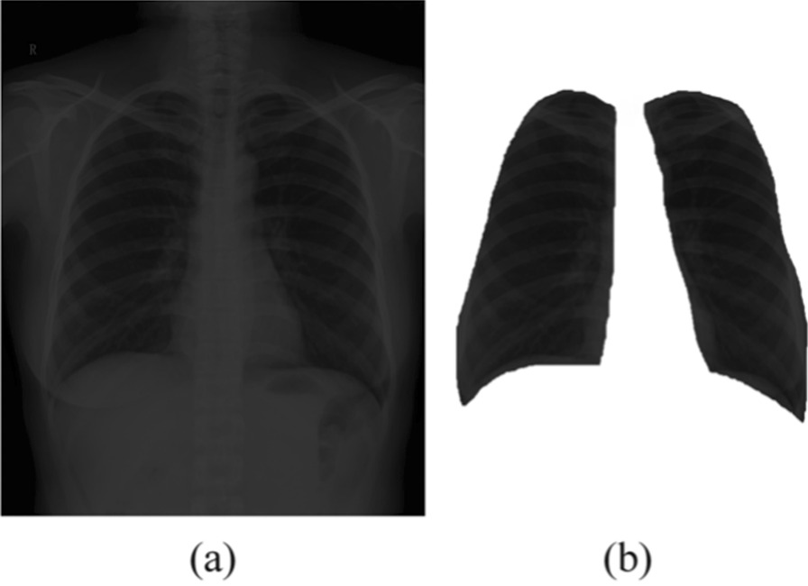 Fig. 2