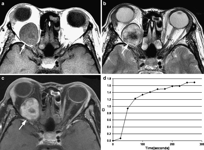 Fig. 4