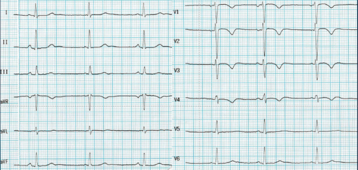 FIGURE 1