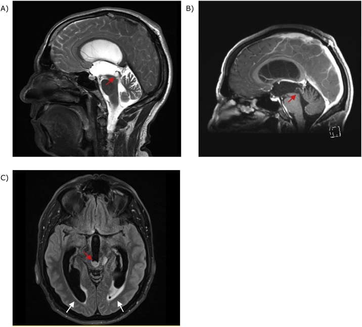 Fig. 1