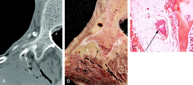 Fig 2.