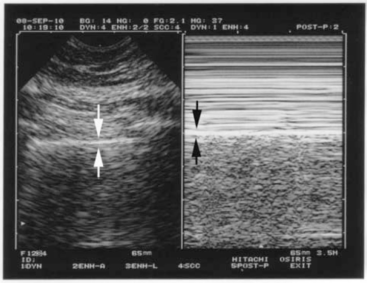 Fig. (3)