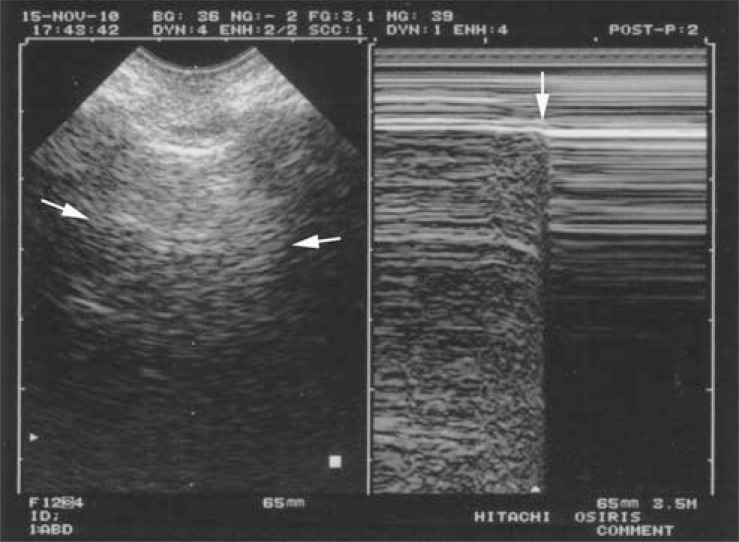 Fig. (8)