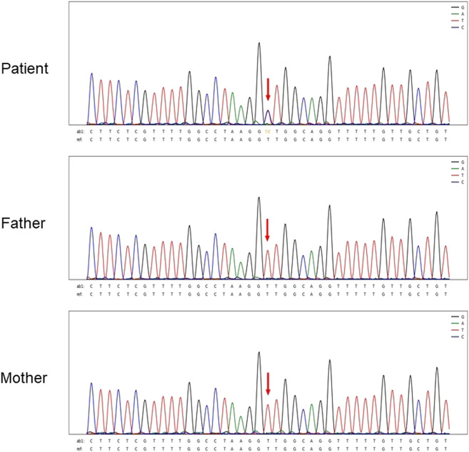 FIGURE 1