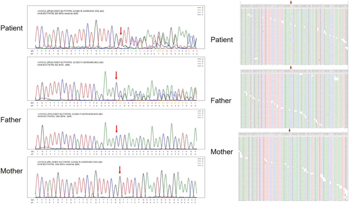 FIGURE 4