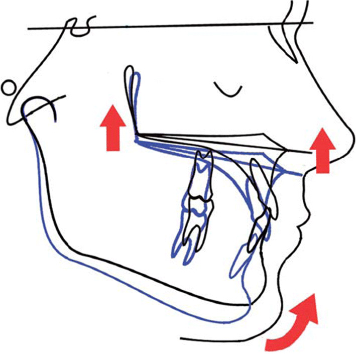 Fig. 1